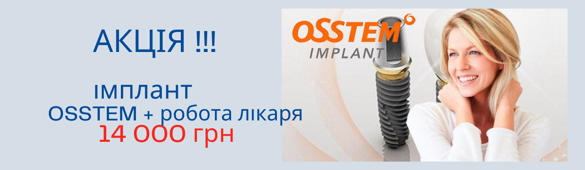 Установка импланта Osstem премиум класса за 14000 грн