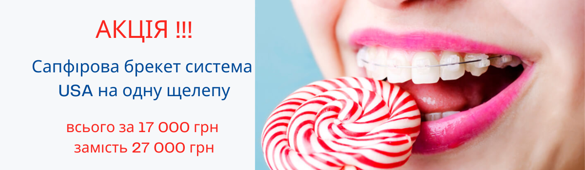 Акція! Сапфіровая брекет система USA (одна щелепа ) 17 000 грн замість 27 000 грн. Ваша економія 1000 грн.